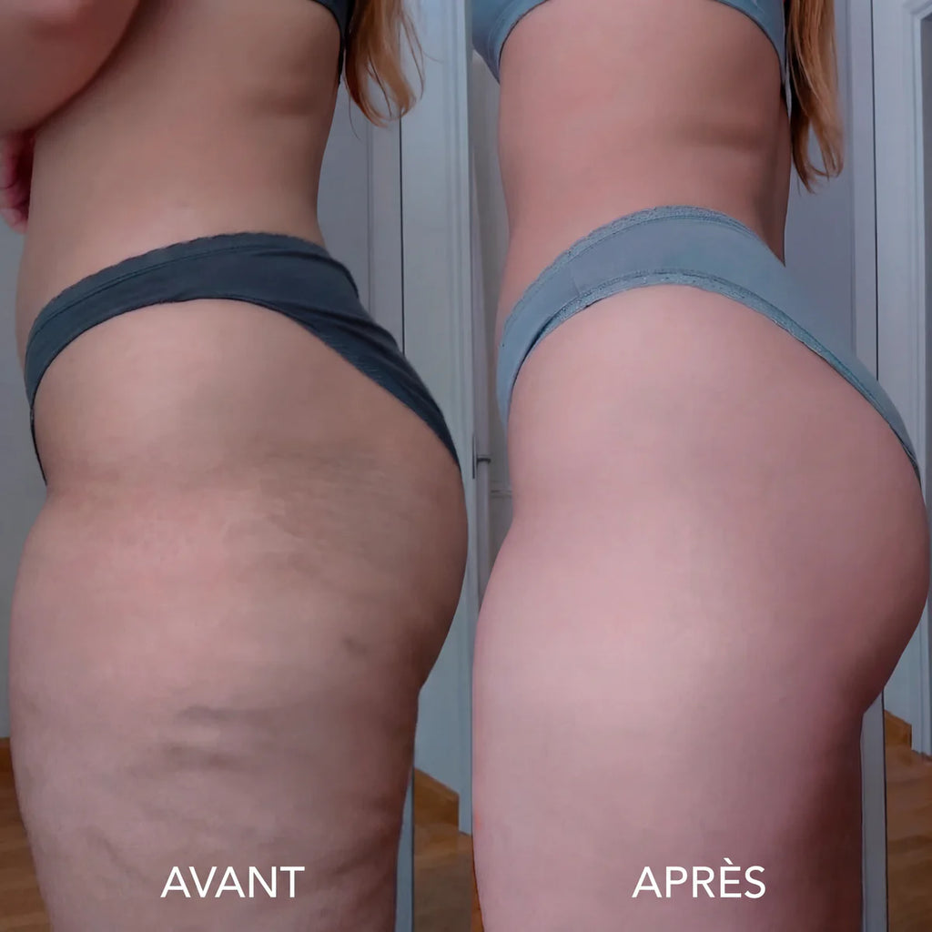🇨🇮 Huile Sculptante & Raffermissante™ – Peau Plus Lisse & Tonifiée