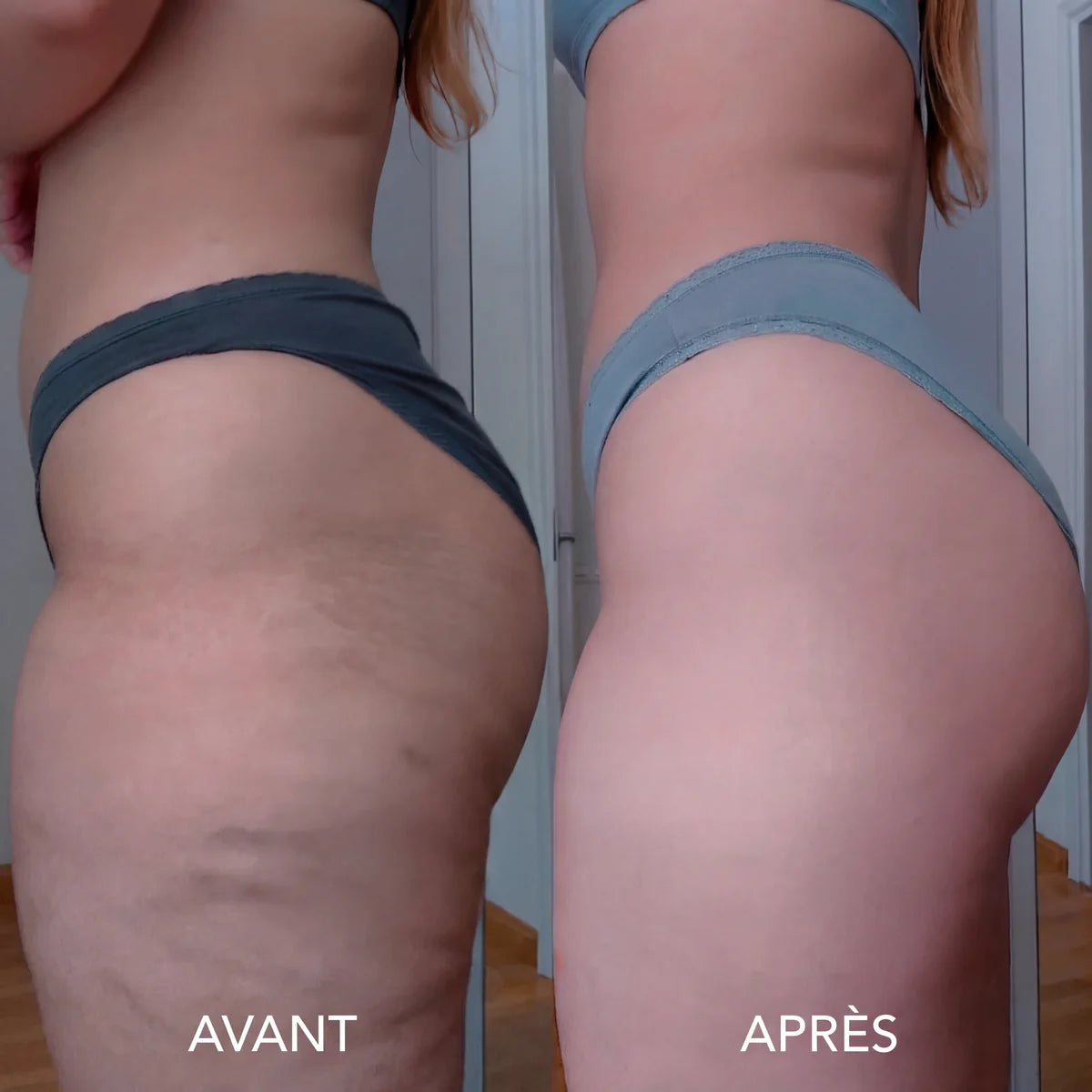 🇨🇮 Huile Sculptante & Raffermissante™ – Peau Plus Lisse & Tonifiée